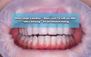 bọc răng sứ toàn sứ