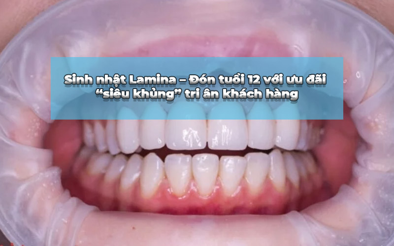 bọc răng sứ toàn sứ