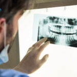 chụp x quang răng khôn bao nhiêu tiền