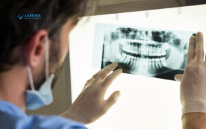 chụp x quang răng khôn bao nhiêu tiền