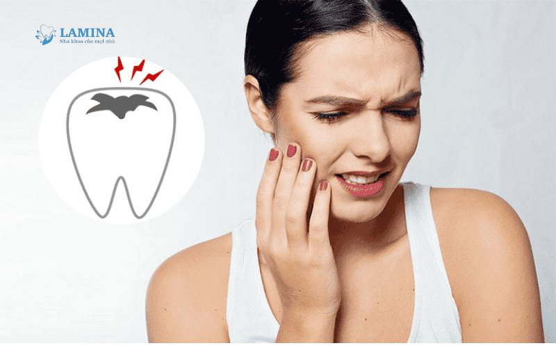 Ê răng: Nguyên nhân, dấu hiệu và 9 cách điều trị dứt điểm tại nha khoa