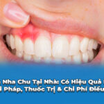 trị viêm nha chu tại nhà