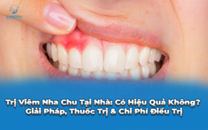 trị viêm nha chu tại nhà