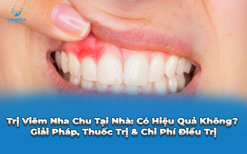 trị viêm nha chu tại nhà