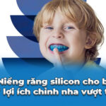 niềng răng silicon cho bé