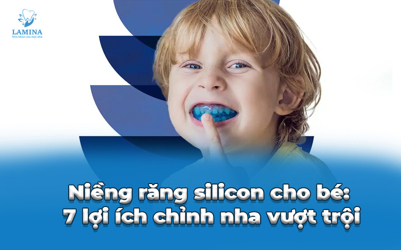 niềng răng silicon cho bé