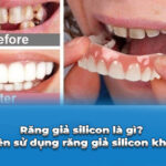 răng giả silicon