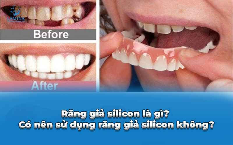 răng giả silicon