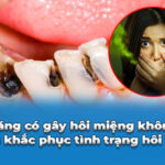 sâu răng có gây hôi miệng không