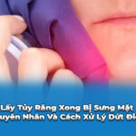 lấy tuỷ xong bị sưng mặt