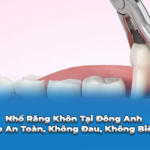 nhổ răng không tại đông anh