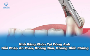 nhổ răng không tại đông anh