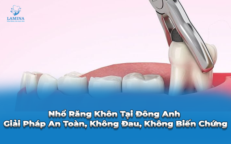 nhổ răng không tại đông anh