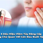 dấu hiệu viêm tuỷ răng cấp