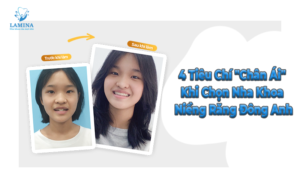 niềng răng uy tín đông anh